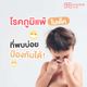 โรคภูมิแพ้: ในเด็กที่พบบ่อย ป้องกันได้