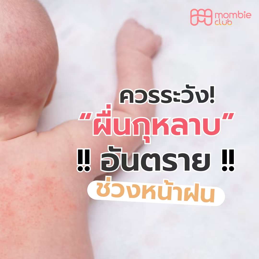 ผื่นกุหลาบ