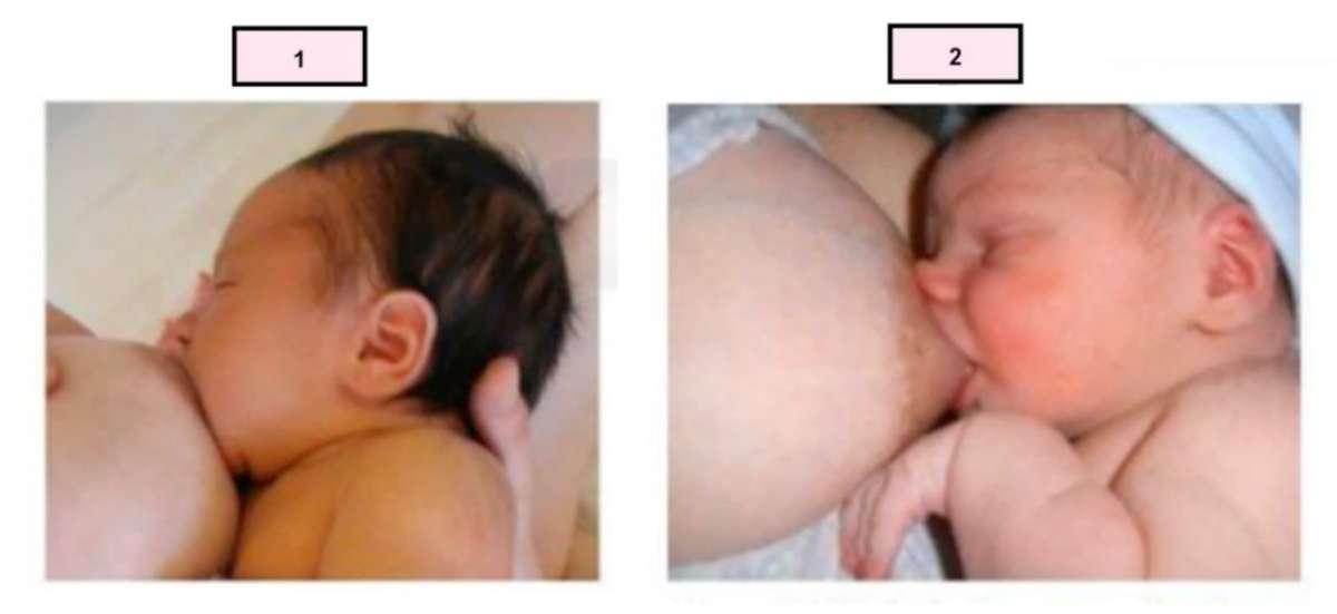 มีภาพ 1 และ 2 คุณแม่คิดว่า ภาพไหนเป็นการดูดนมแม่ที่ได้ประสิทธิภาพที่สุดคะ